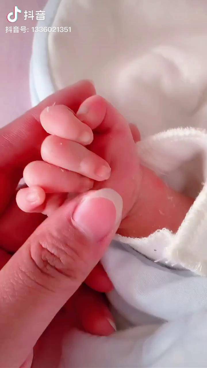 新生儿的"小拳头"一定要及时打开育儿正能量 新生儿护理 育儿经验分享