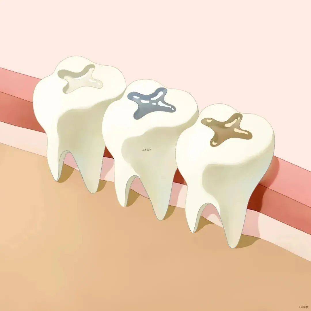 什么是牙周病?牙周病发生的原因是什么?-爱康健齿科