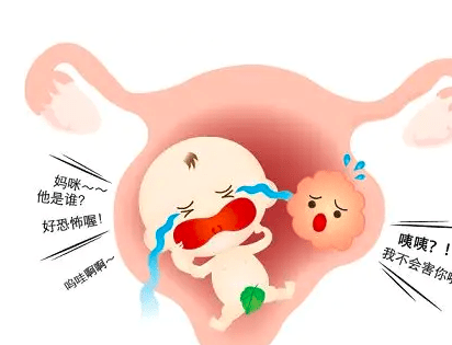 白廣德主任:20%的女性都會忽略,這7種子宮肌瘤需要及時切除!