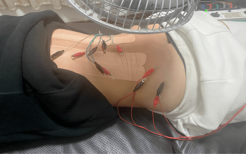 腰肌劳损扎针治疗在2022年1月,我来到了清华大学,报到地点在艺术博物