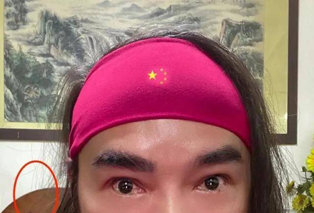 54岁焦恩俊近照吓坏网友,全脸通红眼眶含泪,血压90~180心跳120_身体