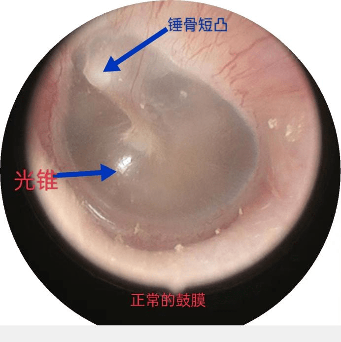 灯照下的耳膜图图片