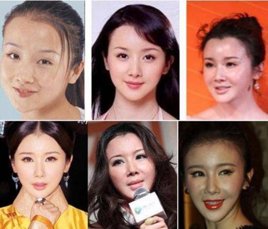 8位“痴迷整容”的女星，有人脸变形，有人丧命，个个让人警醒_刘晓庆_巩新亮_孙菲菲