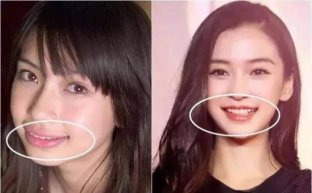 这12位明星,个个嘴里藏一套房,却磨掉了灵气_牙齿_少女_一笑