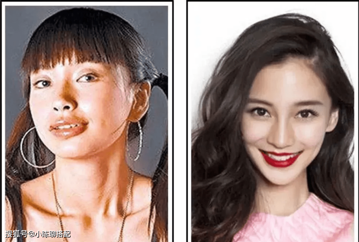 很多人的凸嘴都是后天因素造成的,而这里面最大的罪魁祸首就是口呼吸