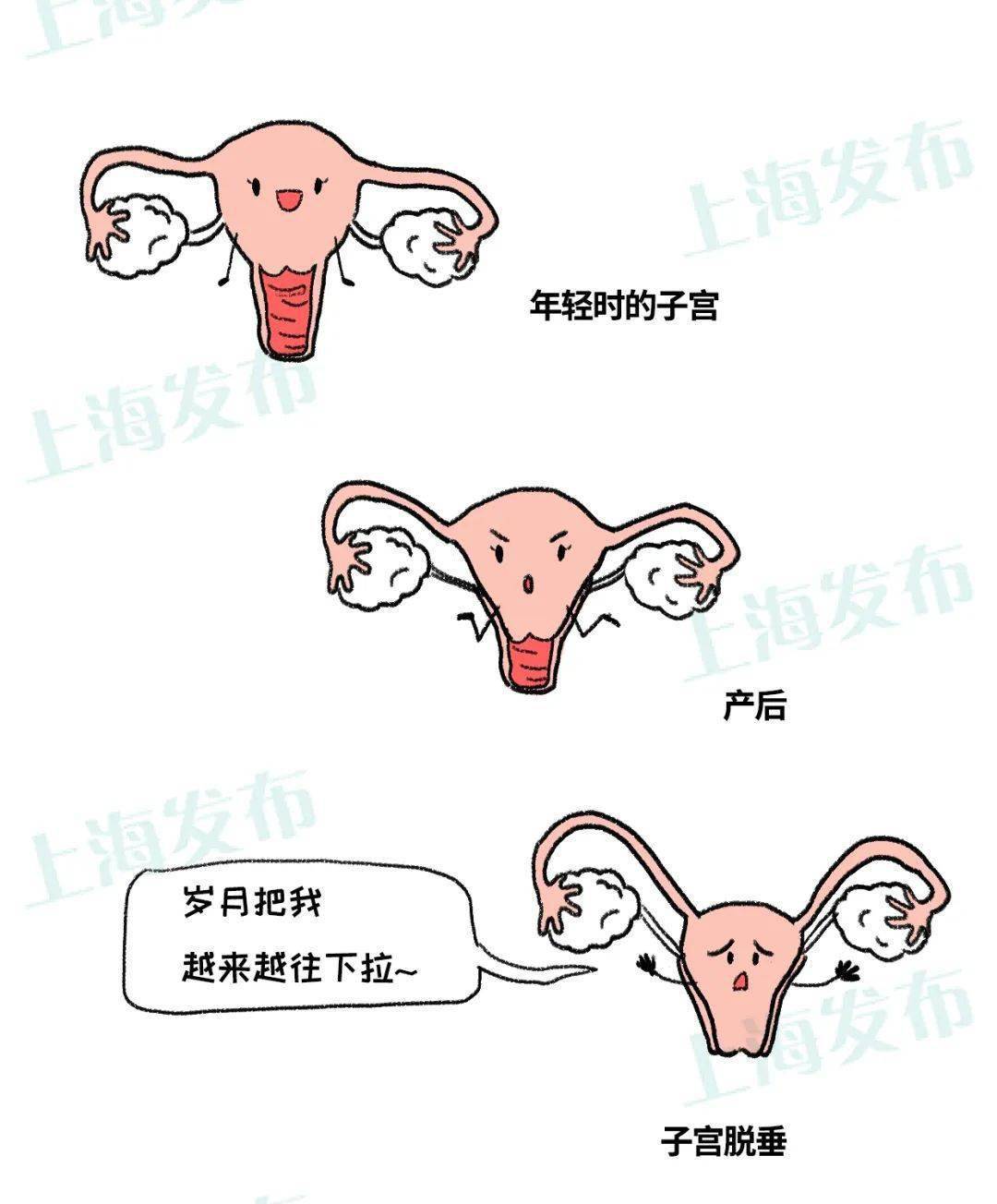 图1-17宫颈组织活检术-妇产科手术-医学