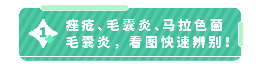 痤疮or毛囊炎？孩子身上这种痘到底是啥？一张图帮你分辨