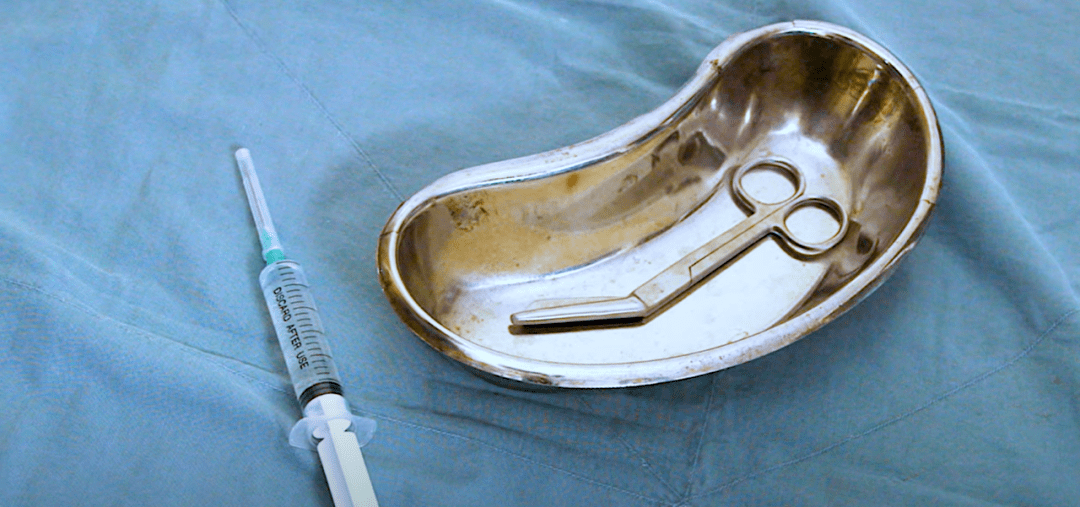 随即,主刀医生熟练地将左手食指和中指从阴道口插入,从侧方撑起了她的