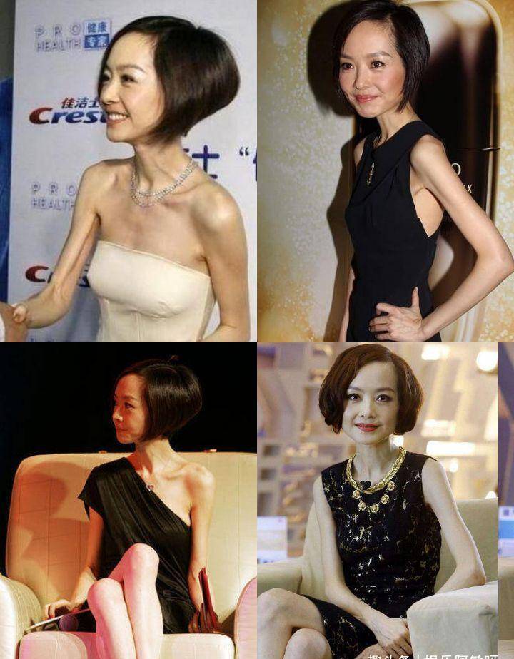 这几位明星求你别再瘦了:棒棒糖,骷髅腿,排骨身材并不好看_减肥_罗云