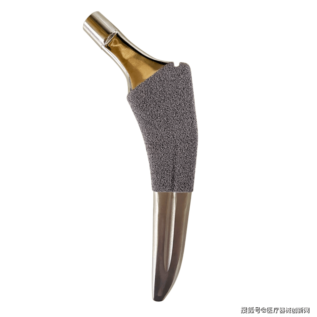 首款国产钽涂层股骨柄获批上市,标志着中国骨科器械研发步入技术创新