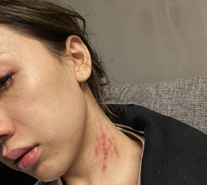 被掐着脖子打满是血痕,男方不忠诚染病劣迹斑斑_free_fever_blow