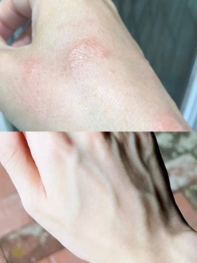 我用起来很安心,而且医生说这种东西有修复细胞和增强免疫力的功效