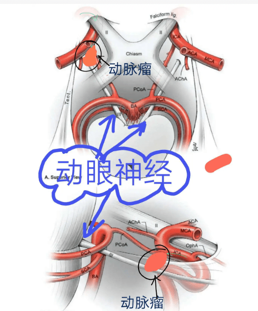 chiasm图片