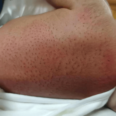 只因这个举动…._温州市中心_毛刺_医生