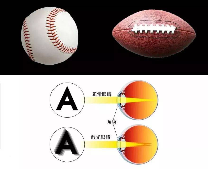 【散光科普】50度的散光,配镜要不要加上?很纠结!!!_视力_视觉_度数
