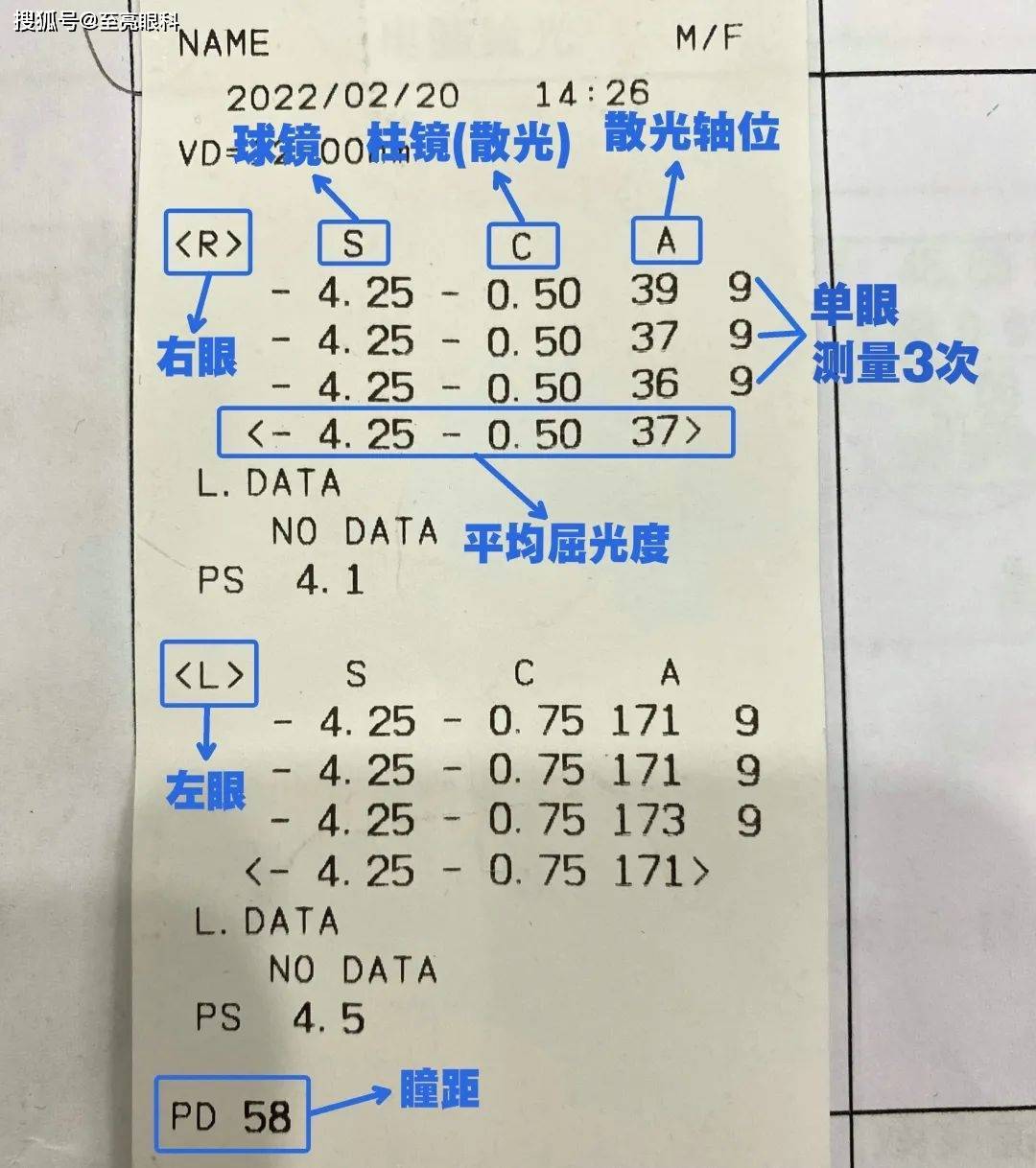 视力检查报告单学生图片