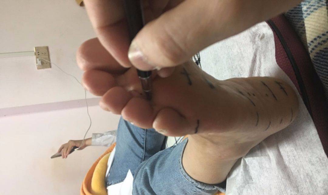 她慢慢移了下腰,"好像是真的不痛了!这个疗法可真的救了我半条命啊.