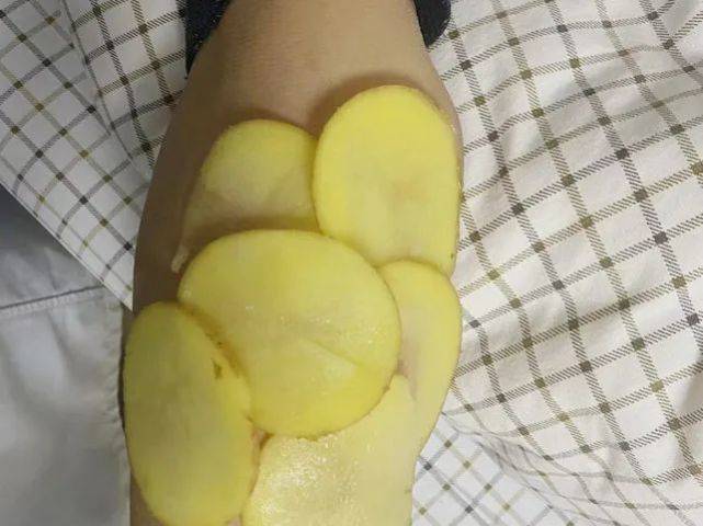 那除了硫酸镁,我们还有没有别的方法呢?