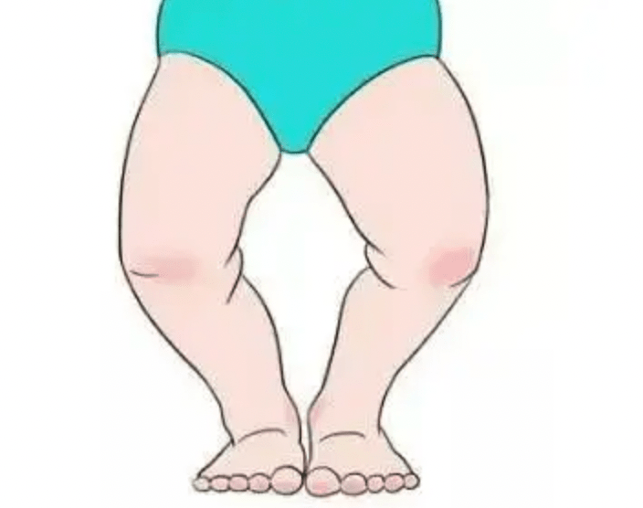 大长腿也是从x型腿o型腿一路发育来的_宝宝_儿童_家长
