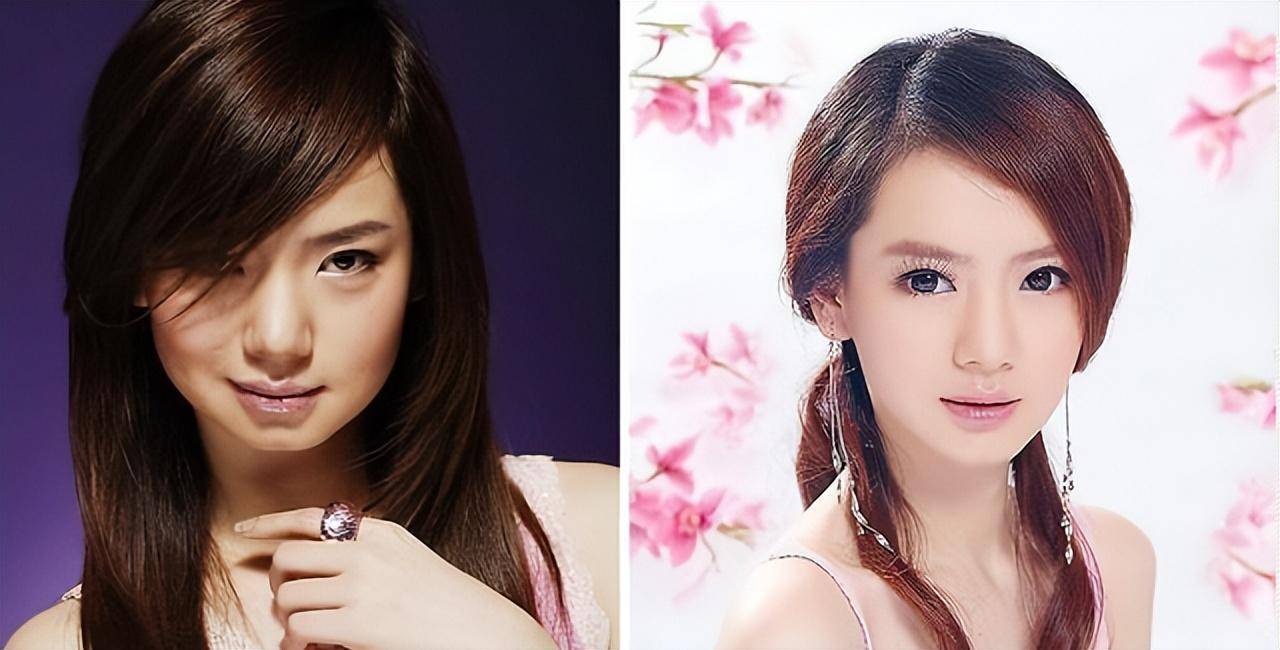 戚薇之前的双眼皮是内双,看不出来,还显的眼睛有种肿眼泡的感觉,而