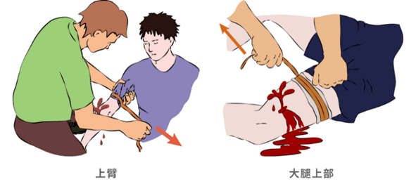 将止血带拉紧,缠肢体两周打结,松紧要适宜,止血带的松紧以刚好能使