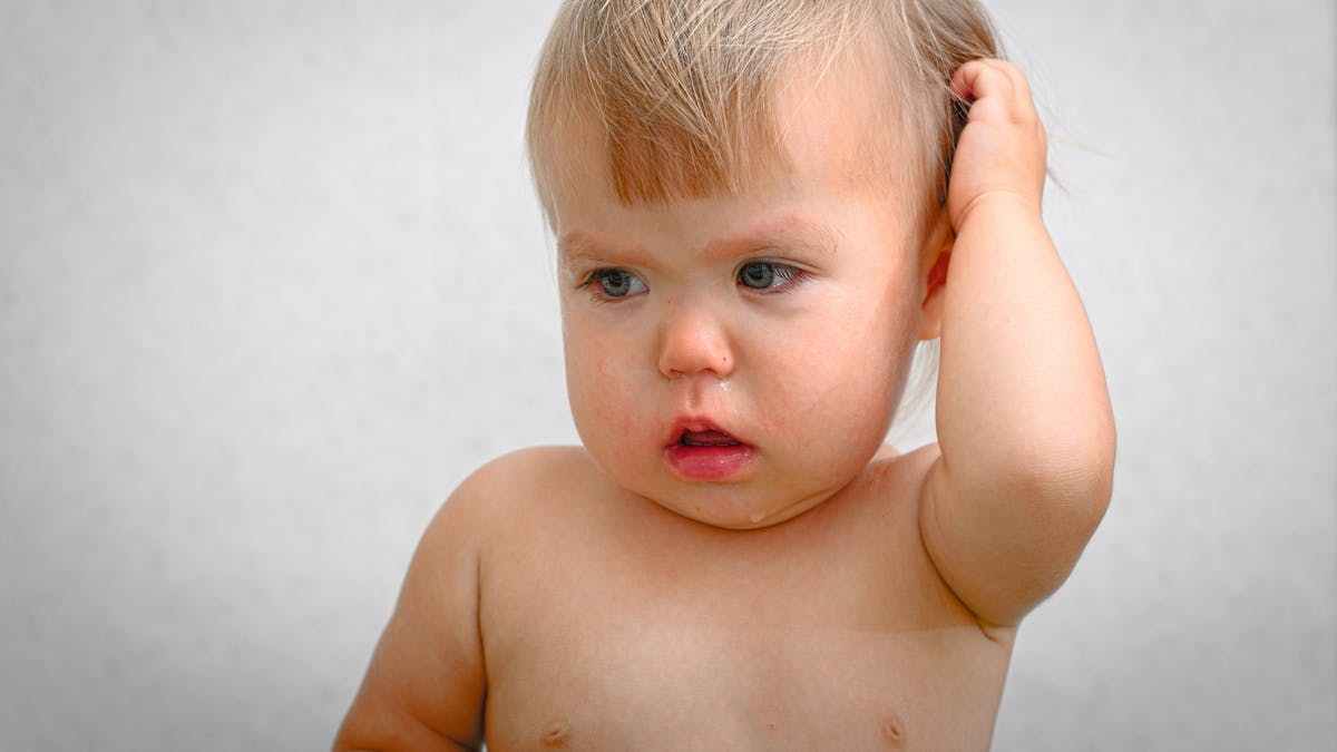 小儿慢性咽炎的表现有哪些及是什么原因引起的？