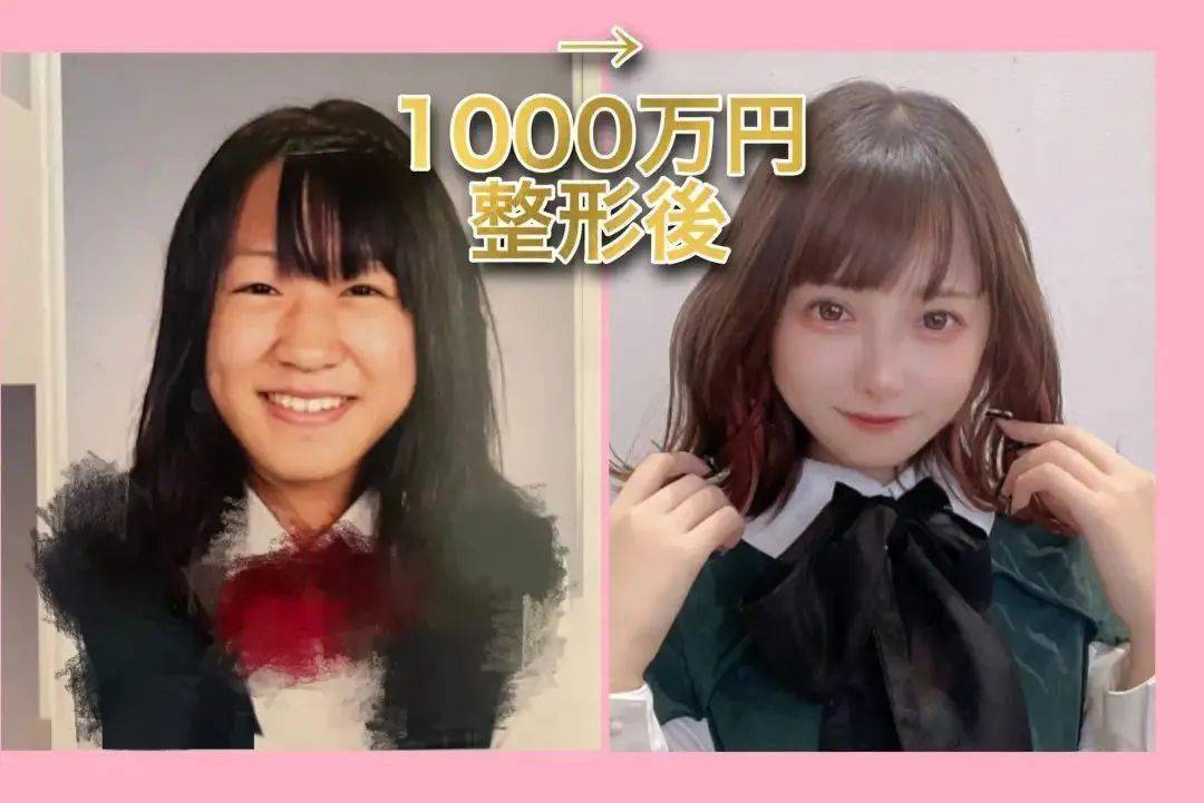 日本驸马咸鱼翻身当街耍大牌 日本小学生出现整形风潮 红白歌会出场名单正式公布丨百通板第108期 小室 相关 疫苗 日本驸马咸鱼翻身当街耍大牌 日本小学生出现整形风潮 红白歌会出场名单正式公布丨百通板第108期 小室 相关 疫苗