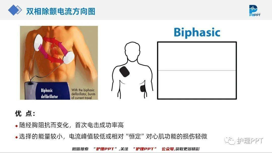 【ppt】除颤仪的使用及其护理（附视频）