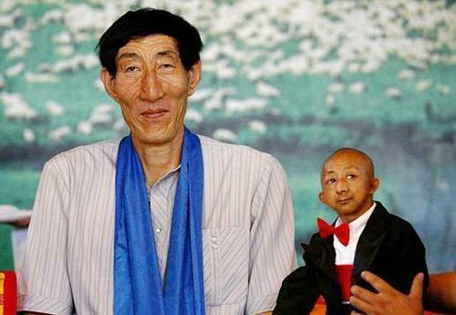 那些坚持要孩子的巨人症和侏儒症患者们,他们的后代怎么样呢?