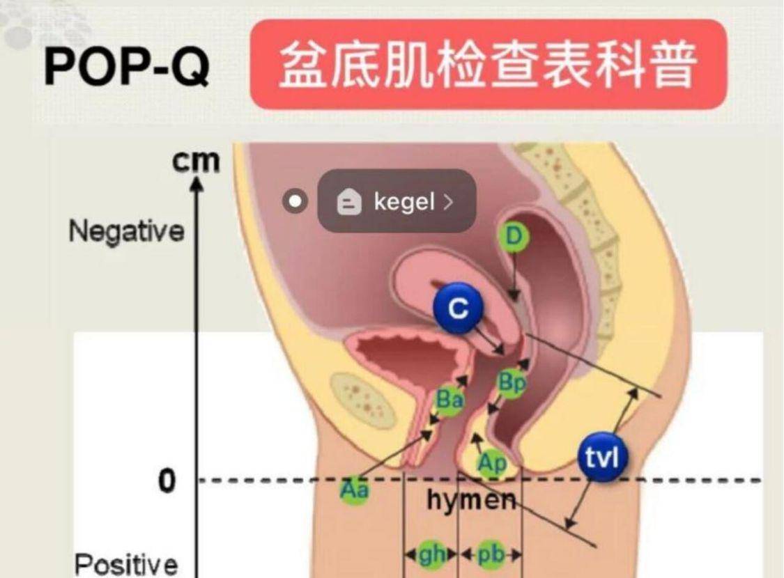 产后修复干货|教你轻松看懂盆底肌检查报告!_锻炼_测试_问题