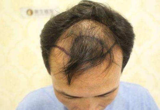 39岁小沈阳这是怎么了?