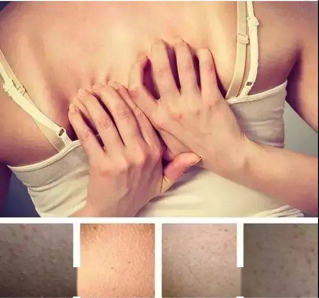 一个被嫌弃的鸡皮肤怎么办(一个被嫌弃的鸡皮肤怎么办啊)