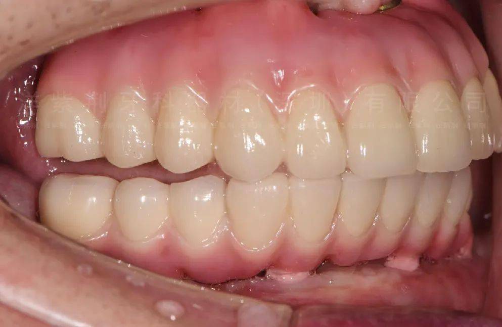 定期复查洋紫荆,是国内知名的牙科技工中心,成立于1998年.