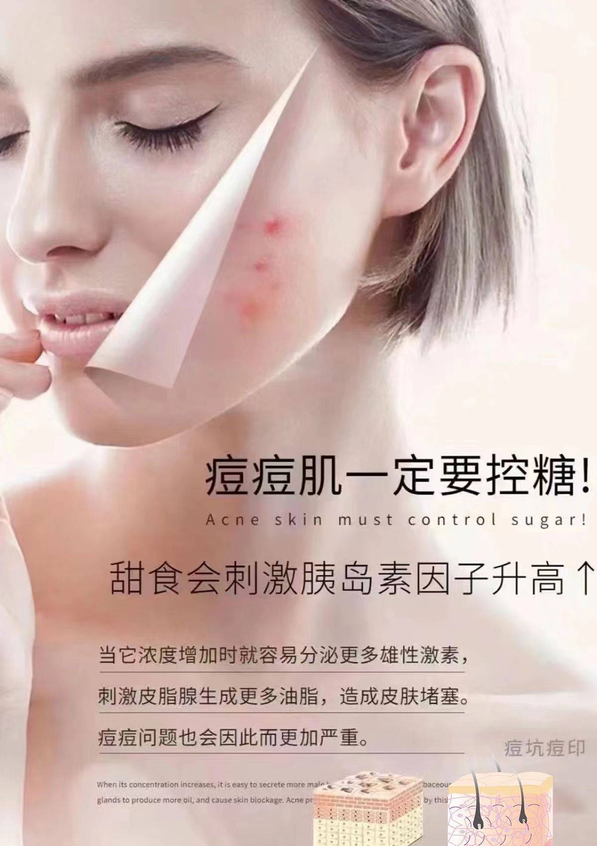 金芝堂丨美容院祛痘管理高级文案&海报免费领取_青春_长痘痘_细胞