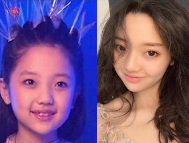 好凄惨“冰柠檬”张兆艺自曝遭家暴，满脸淤青眼里满是泪水，妈妈是亲历者