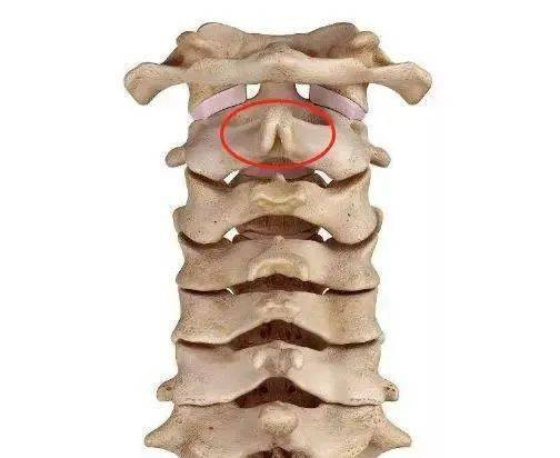 触诊方法是从头后正中线向下滑动摸到的第一个骨性凸起便是第二颈椎的