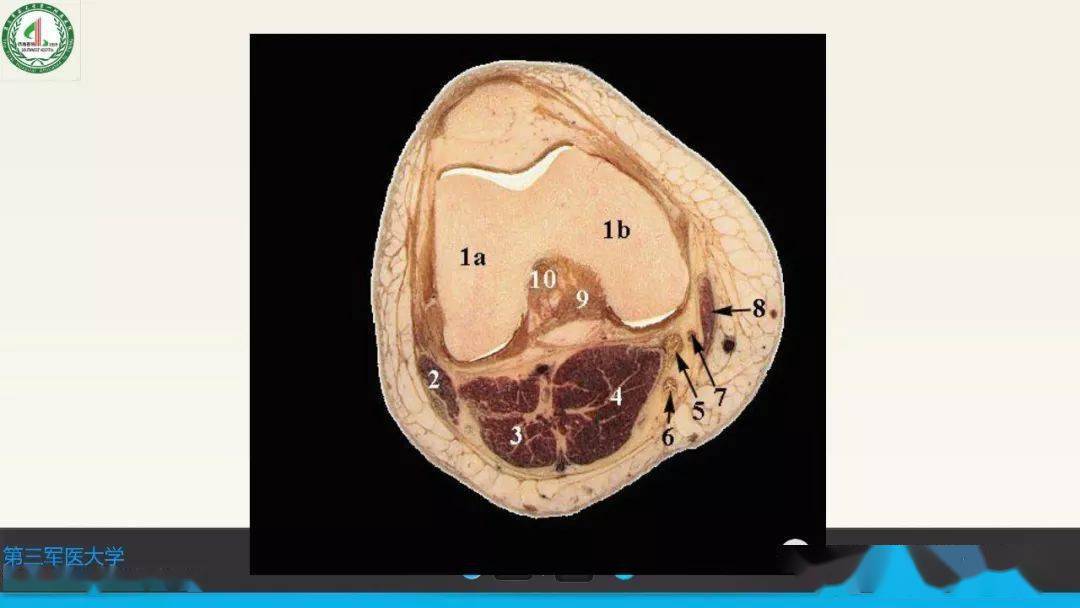 超讚,這個滿分膝關節韌帶mri診斷課件有視頻課程了!_解剖_影像_全網