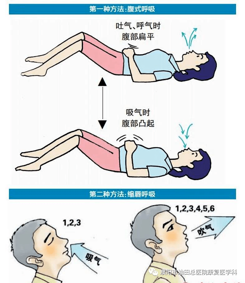 新冠阳康后不可忽视康复锻炼