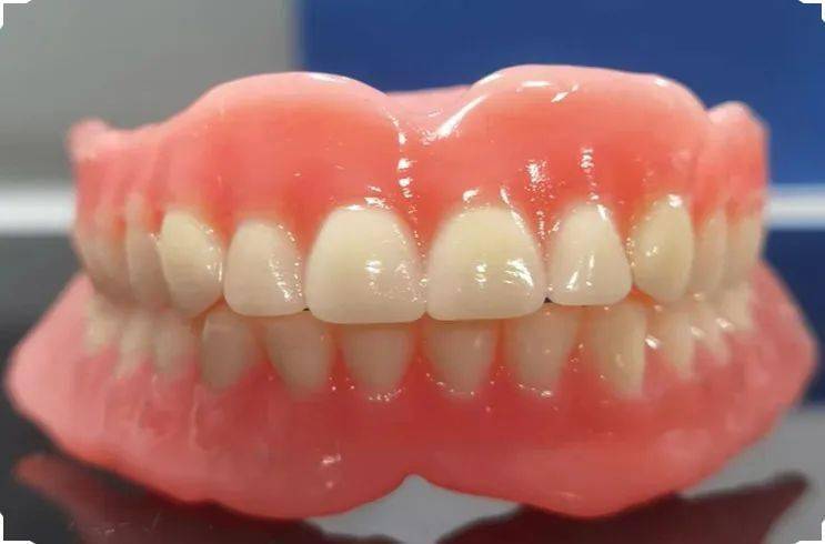 吸附性活动义齿简解_患者_口腔_人群