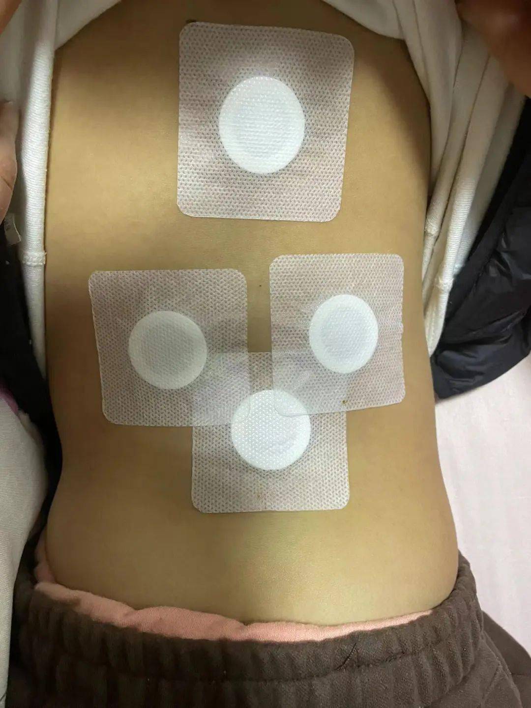 家长们,把握生长好时机,桐庐一院春季"生长贴"开贴啦!