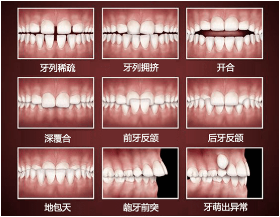 央视新闻:7岁左右是第一个牙齿矫正黄金期_进行_治疗_孩子