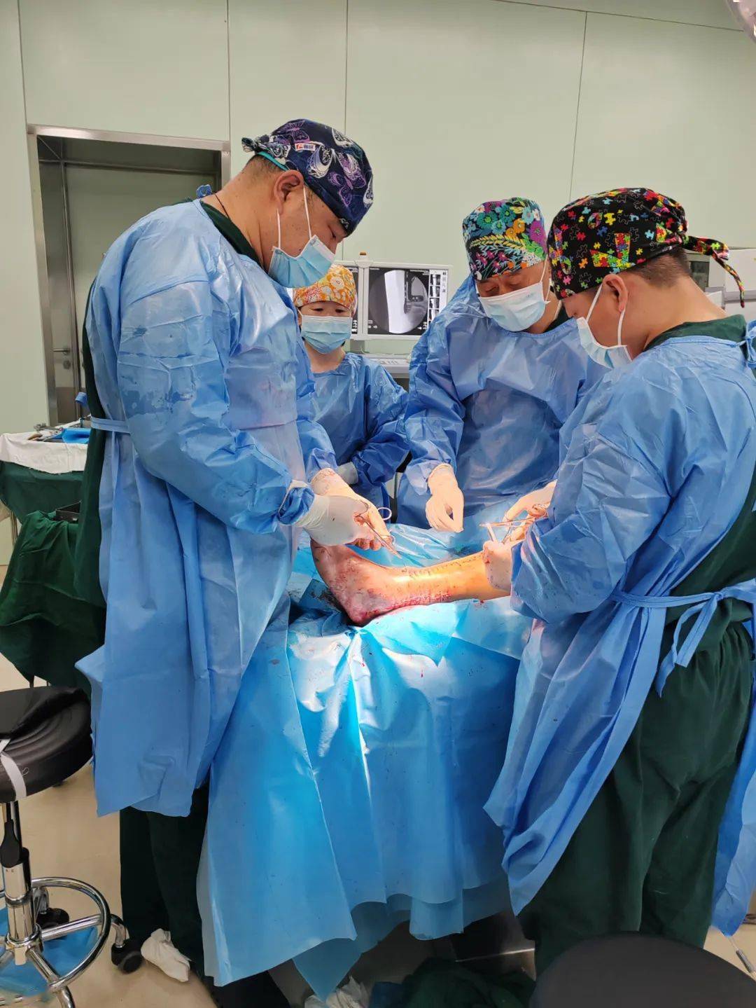 首例!旗人民医院外科独立自主完成高难度手术