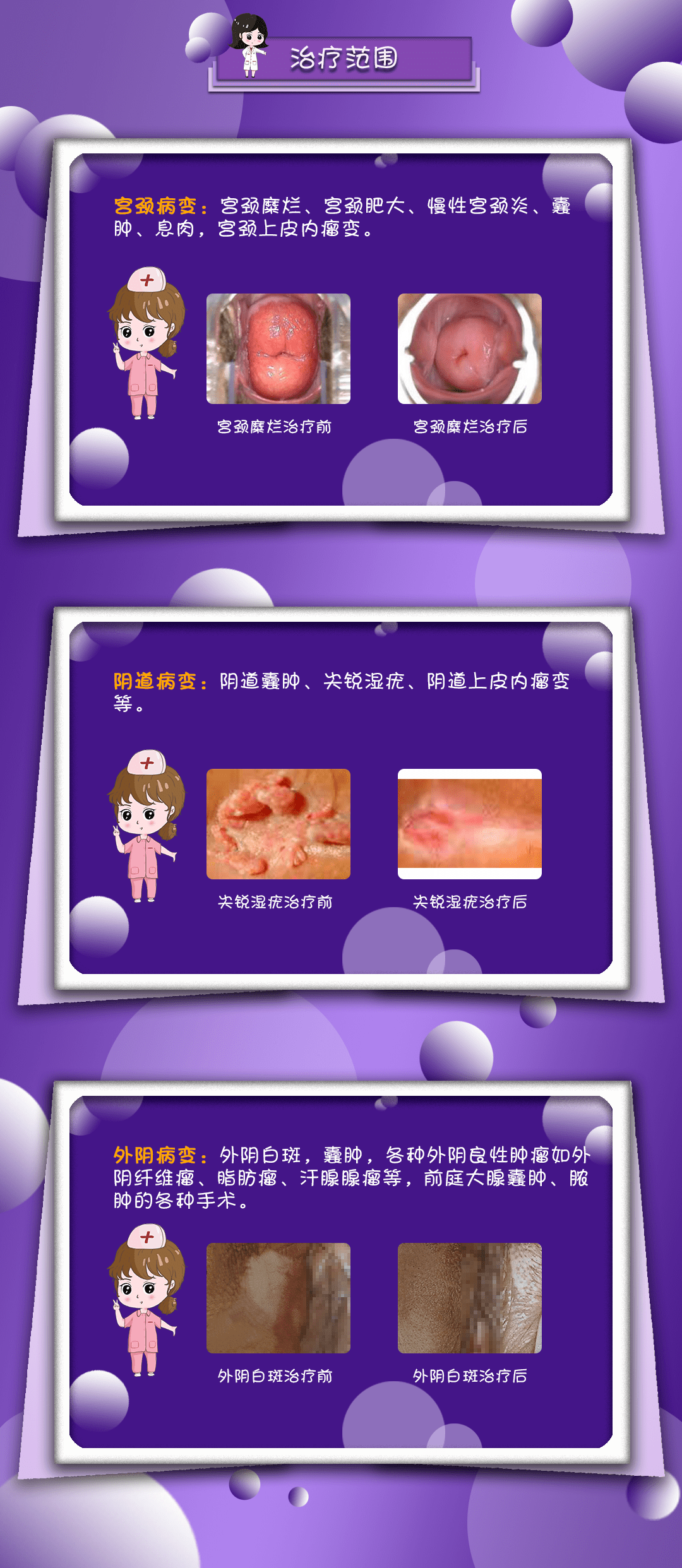 前庭大腺肿大图片