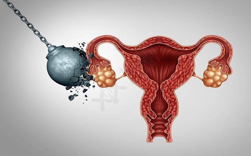 女生身上若出现1臭,2黑,很遗憾通知你:子宫或已"千疮百孔"!