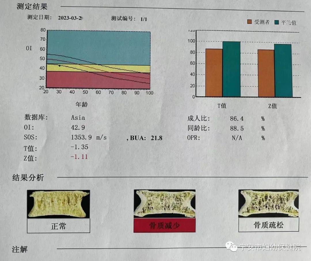 什么是骨密度检查?都哪些人需要做呢?