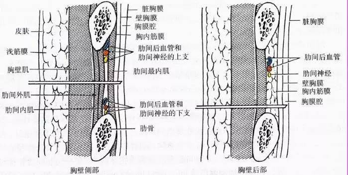 气胸穿刺部位示意图图片