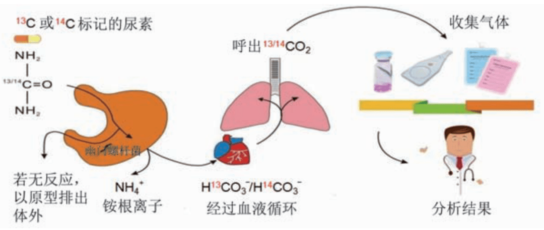 尿素_方法_试验