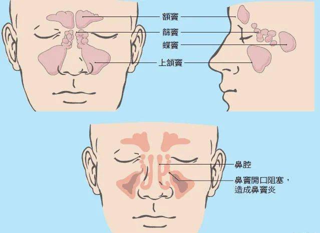 好鼻和鼻炎对比内部图图片