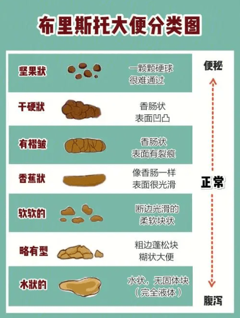 形态布里斯托大便分类法了解一下影响睡眠甚至影响生长发育引发痔疮