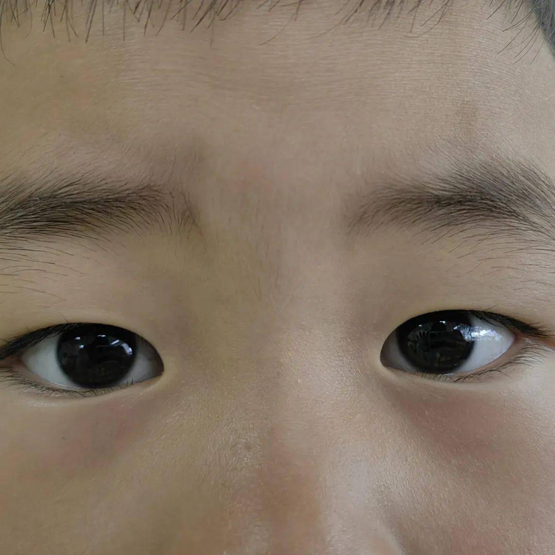 爱眼护眼,守护"视"界